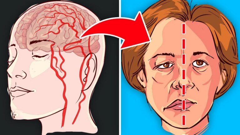 Questo semplice gesto alimentare può ridurre il rischio di ictus… Scopri quali sono!