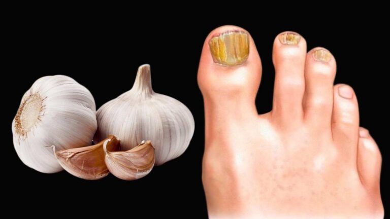 Questo semplice gesto elimina funghi e verruche in modo naturale e senza sforzo…